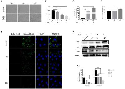 Enterovirus A71 utilizes host cell lipid β-oxidation to promote its replication